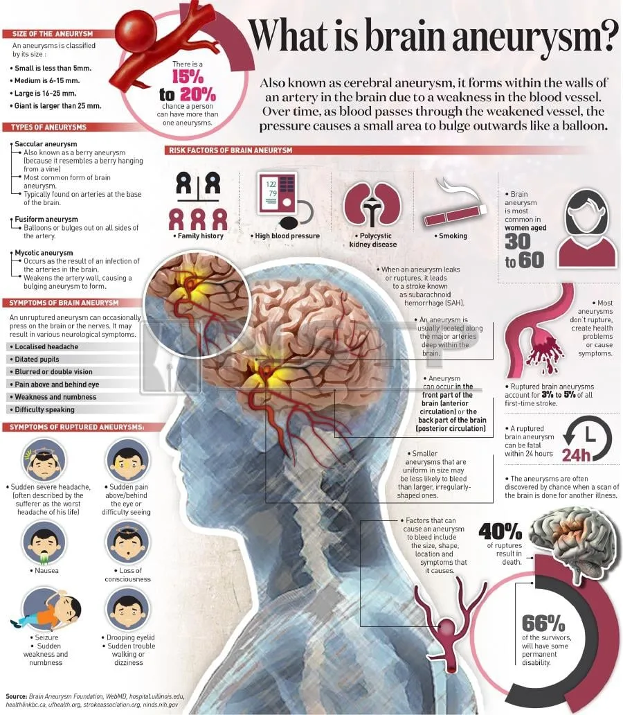 brain_aneurysm_infographic