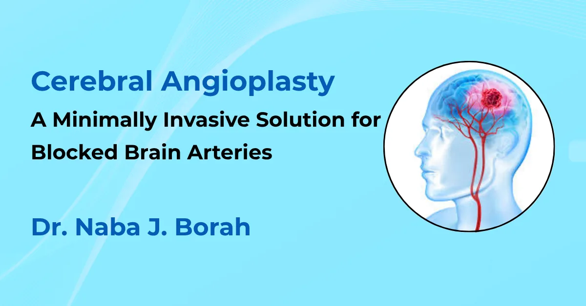 Cerebral Angioplasty by Dr Naba J Borah