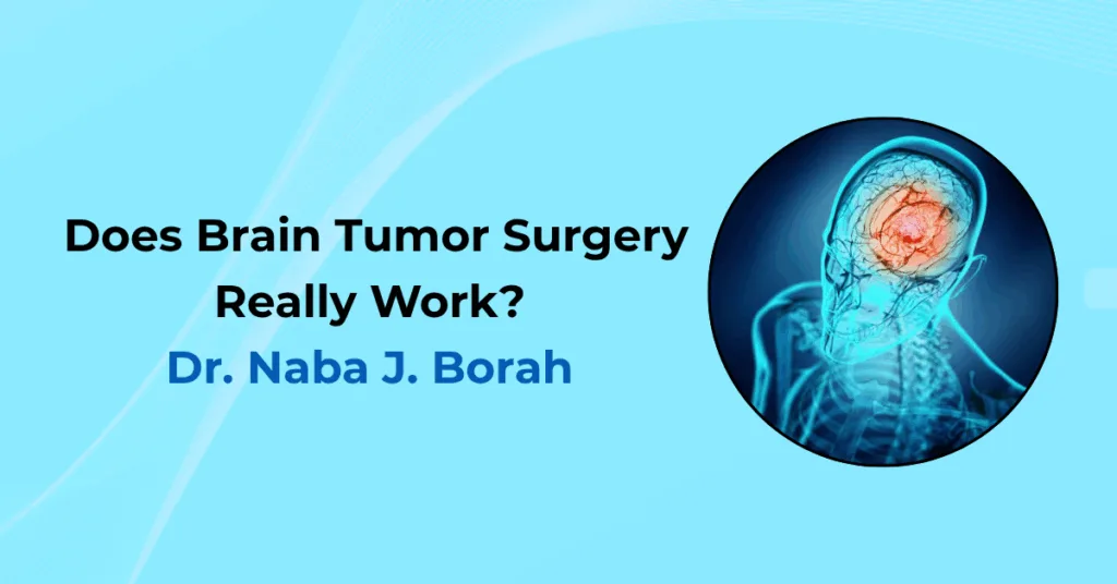 Does Brain Tumor Surgery Really Work Article By Dr Naba J Borah