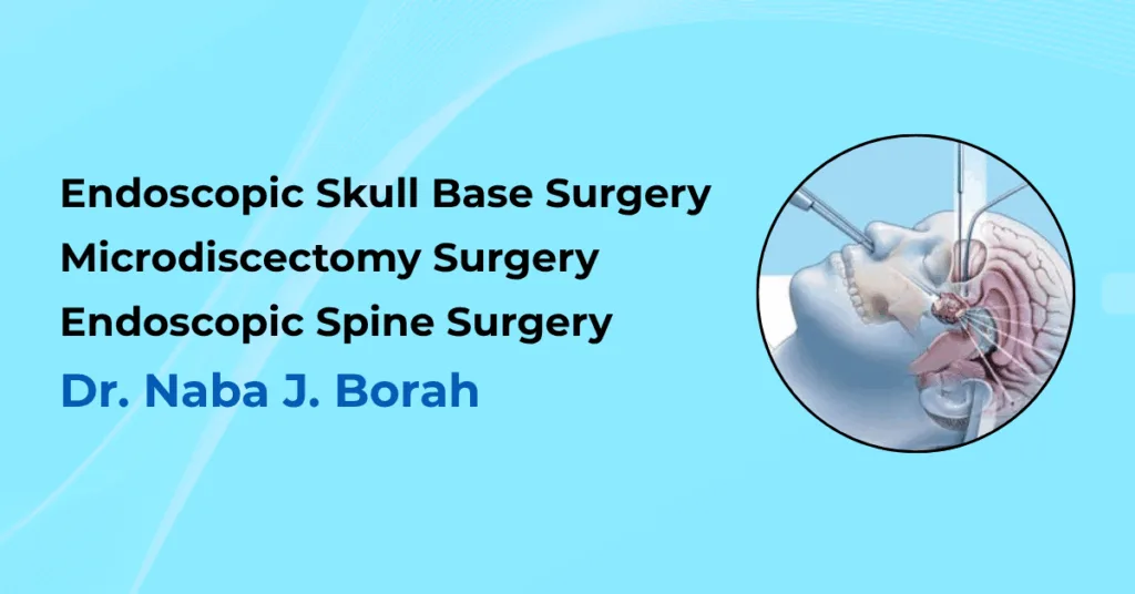 Endoscopic Skull Base Surgery by Dr Naba J Borah