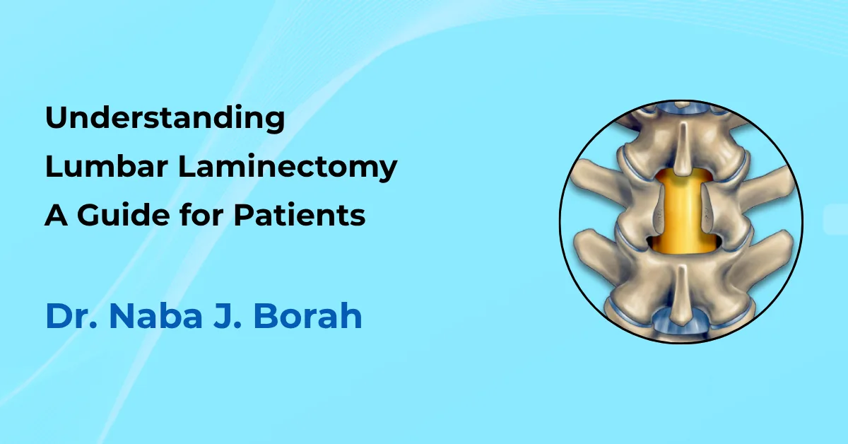 Understanding Lumbar Laminectomy by Dr Naba J Borah
