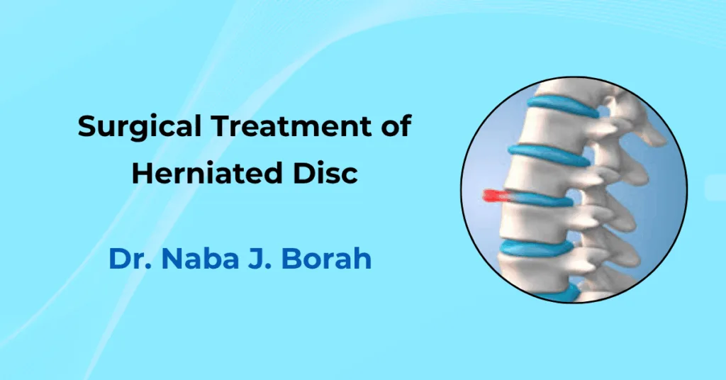 Surgical Treatment of Herniated Disc by Dr Naba J Borah