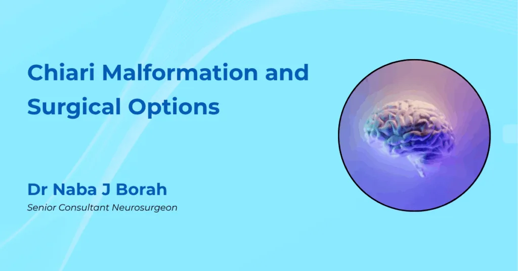 Chiari Malformation and Surgical Options by Dr Naba J Borah