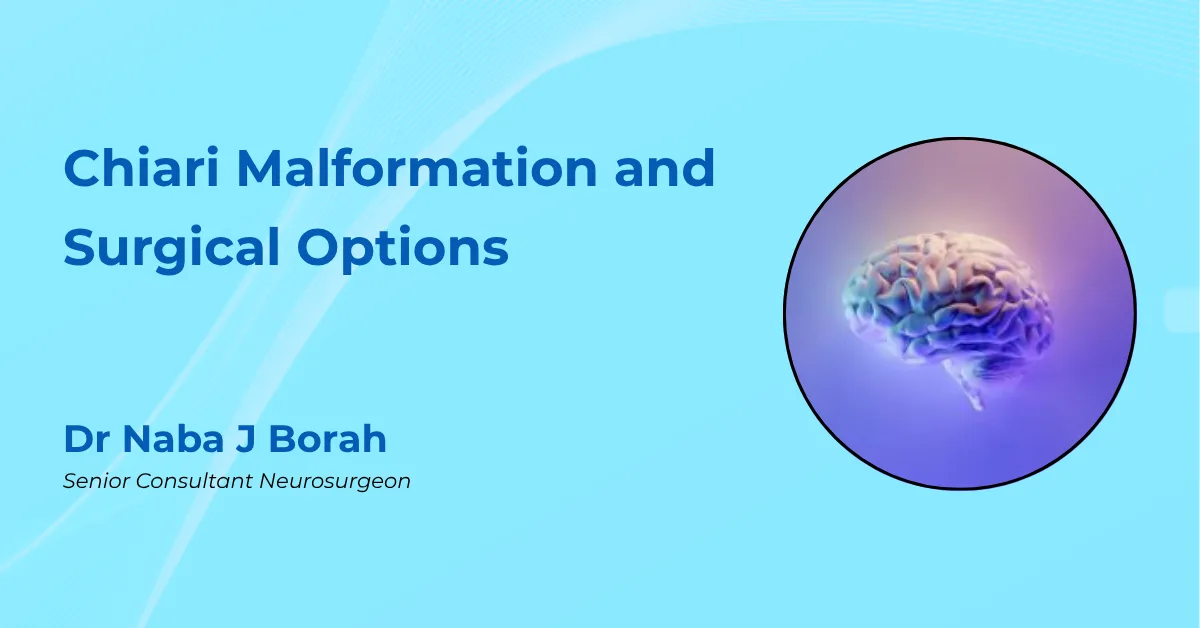 Chiari Malformation and Surgical Options by Dr Naba J Borah