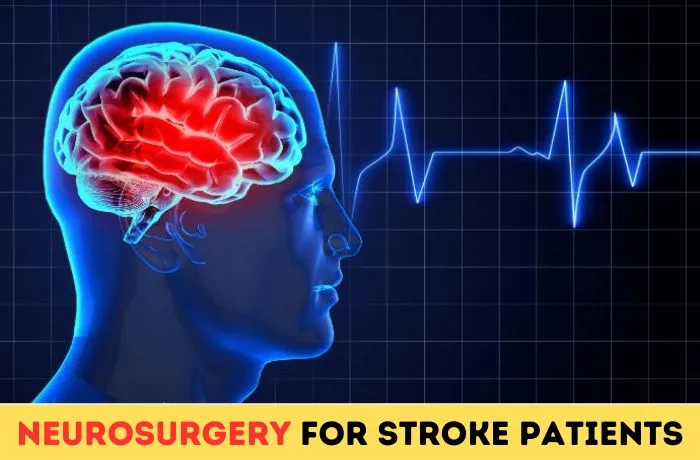 Stroke Surgery for Neurosurgery